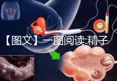 【圖文】一圖閱讀:精子和卵子結合有多難！