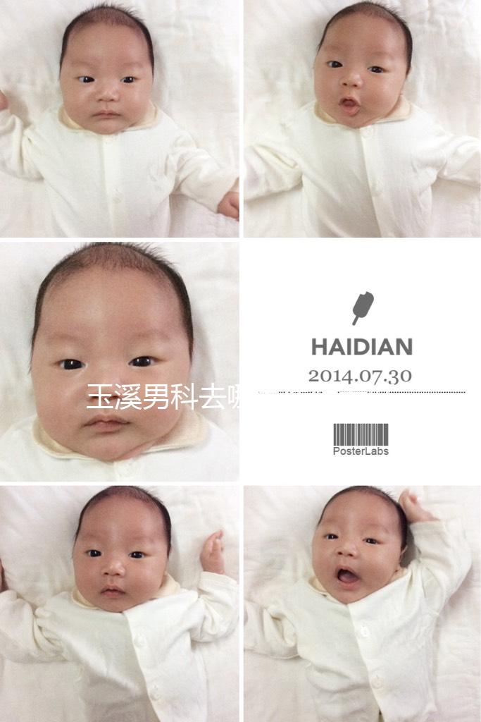 玉溪男科去哪家醫(yī)院看好，怎么選攻略，這個(gè)排行榜不要錯(cuò)過(guò)