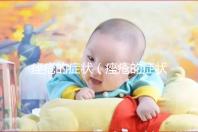 痤瘡的癥狀(痤瘡的癥狀表現(xiàn)有哪些)