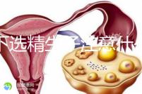 私下選精生子注意什么細節(jié)要早知，選擇正規(guī)機構最重要