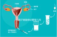 縱隔子宮能做試管嬰兒嗎?醫生:可以做,但要手術治療再進周