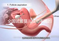 全國試管嬰兒成功率高的醫院有哪些?(全國試管嬰兒成功率高的醫院目錄一覽)