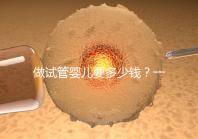 做試管嬰兒要多少錢?一起算筆經濟賬