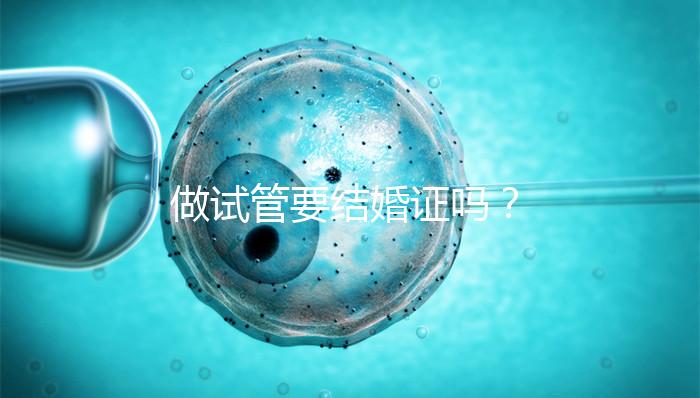 做試管要結(jié)婚證嗎?
