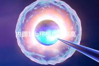 內(nèi)膜10b移植成功率高不高,容不容易著床得看這幾個(gè)方面