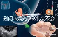 別問(wèn)未婚先孕彩禮會(huì)不會(huì)少了，一分不給也不無(wú)可能