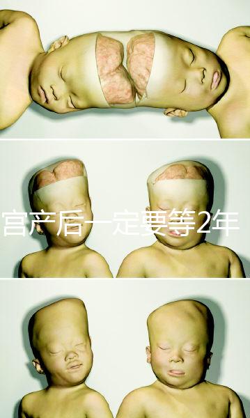 剖宮產后一定要等2年，才能試管嬰兒懷孕嗎？