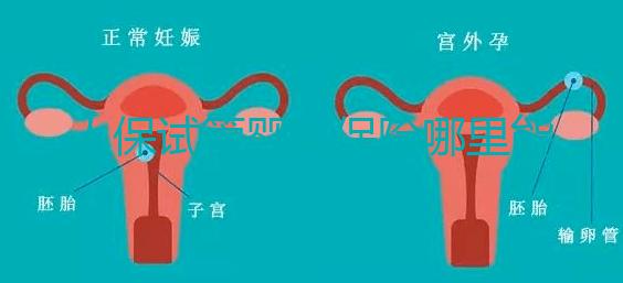 人保試管嬰兒保險(xiǎn)哪里能買、怎么買速覽,一篇看懂不踩坑