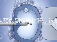 從預(yù)約到操作過程,這份tct檢查流程攻略請查收