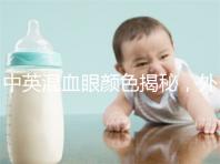 中英混血眼顏色揭秘，外觀特征，長什么樣的快速收藏