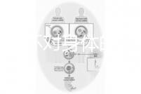 揭秘上環對身體的5大壞處，女人別再無知了