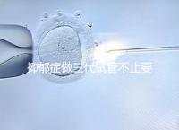 抑郁癥做三代試管不止要基因檢測，這兩大條件也得滿足