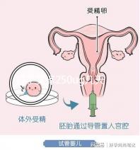 打了艾澤250ug幾天能代謝完戳，第十天別還不敢走下一步