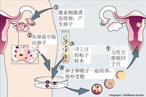 來看看,北京家圓醫(yī)院做三代試管費用總共多少?