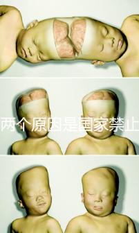 有兩個原因是國家禁止中非混血中國會接受嗎？