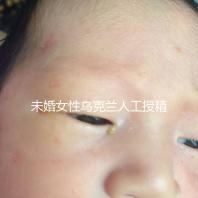 未婚女性烏克蘭人工授精必看！醫(yī)療及生活費用明細預覽