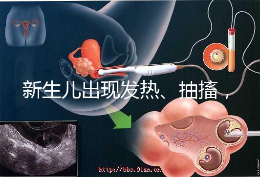 新生兒出現(xiàn)發(fā)熱、抽搐,很可能是胎毒的表現(xiàn)