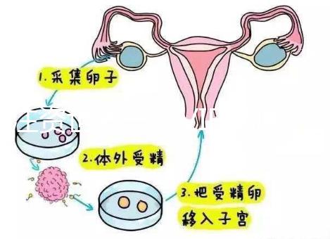 注資世界一流VIF資源