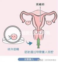 孕檢時b超醫(yī)生透露懷男寶女寶暗語寶典，一語戳中有心人！