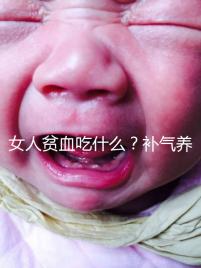 女人貧血吃什么？補(bǔ)氣養(yǎng)血，掌握這五個技巧，讓你煥發(fā)青春光彩