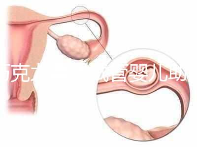 巧克力囊腫試管嬰兒助孕應先治療？網友看法均有差異