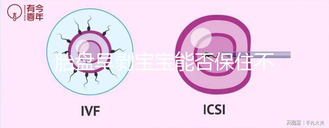 胎盤早剝寶寶能否保住不一定！及時治療和護理很重要