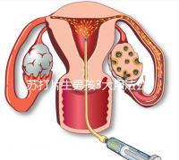 蘇打片生男孩3大用法公布，同房塞陰還是口服分情況