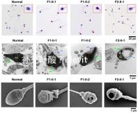 補充葉酸？elevit愛樂維那你不得不了解
