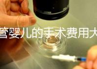 試管嬰兒的手術費用大概是多少？