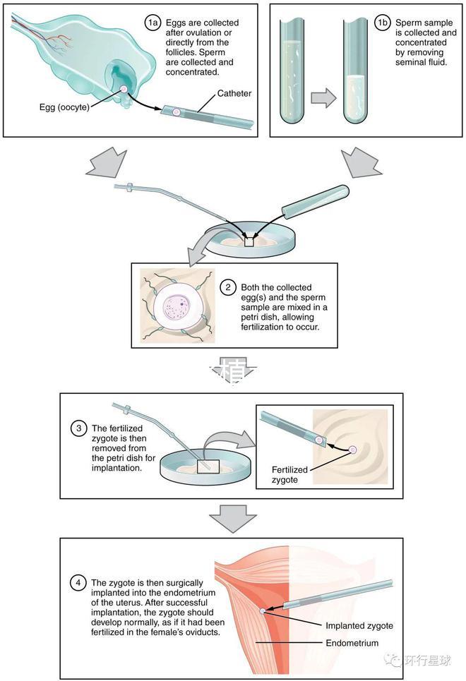 試管嬰兒移植手術(shù)(試管嬰兒移植手術(shù)需要多長時間)