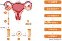 試管嬰兒專(zhuān)家醫(yī)院(試管嬰兒專(zhuān)家醫(yī)院排名)