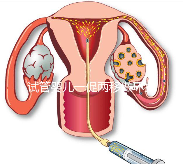 試管嬰兒一促兩移做環扎好看嗎？小心這些影響