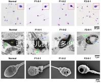 試管嬰兒費用是多少錢(試管嬰兒費用是多少錢一次)