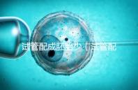 試管配成胚胎少(試管配成胚胎少原因)