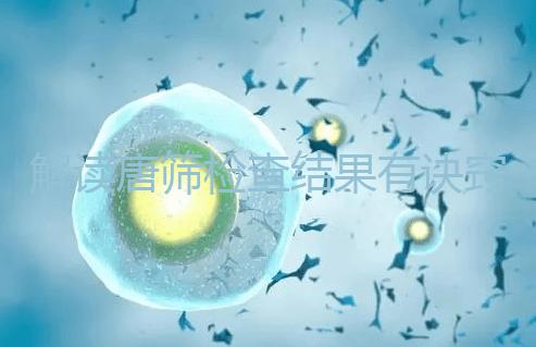 解讀唐篩檢查結(jié)果有訣竅,會看報告單上的正常值范圍是關(guān)鍵