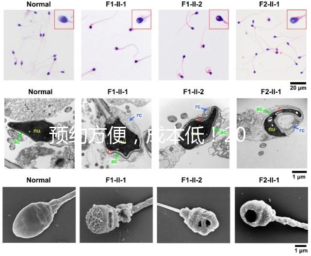 預(yù)約方便，成本低！2024年西安新城、臨潼、雁塔四維彩超指南