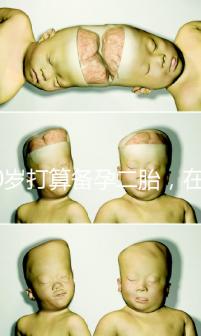 40歲打算備孕二胎，在義馬市還能做試管嬰兒嗎？