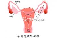 1分鐘解說讓你讀懂,排卵試紙白板一根線等各個反應(yīng)