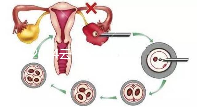 2024云南產(chǎn)假158天怎么算?新政策中,男方培育假貨