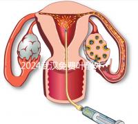 2024武漢免費葉酸外國人可以領取，符合條件就來江漢區