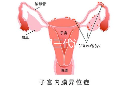 2025昆明三代試管助孕費用一覽，8-15萬元，價格透明公開自主選擇